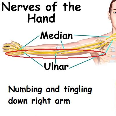 Right hand and arm always numb and tingling...