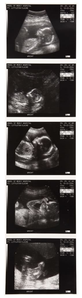 clairebabyscan.jpg
